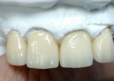 Illumination Dental Arts