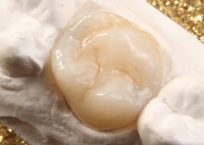 Illumination Dental Arts
